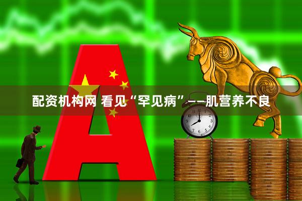 配资机构网 看见“罕见病”——肌营养不良